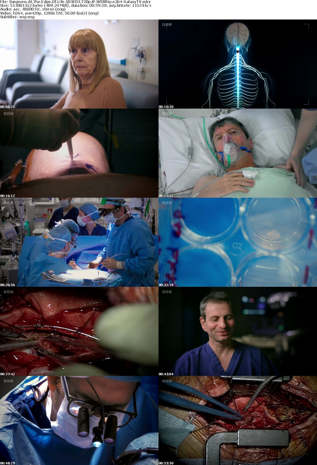 Surgeons At The Edge Of Life S03 COMPLETE 720p iP WEBRip x264-GalaxyTV
